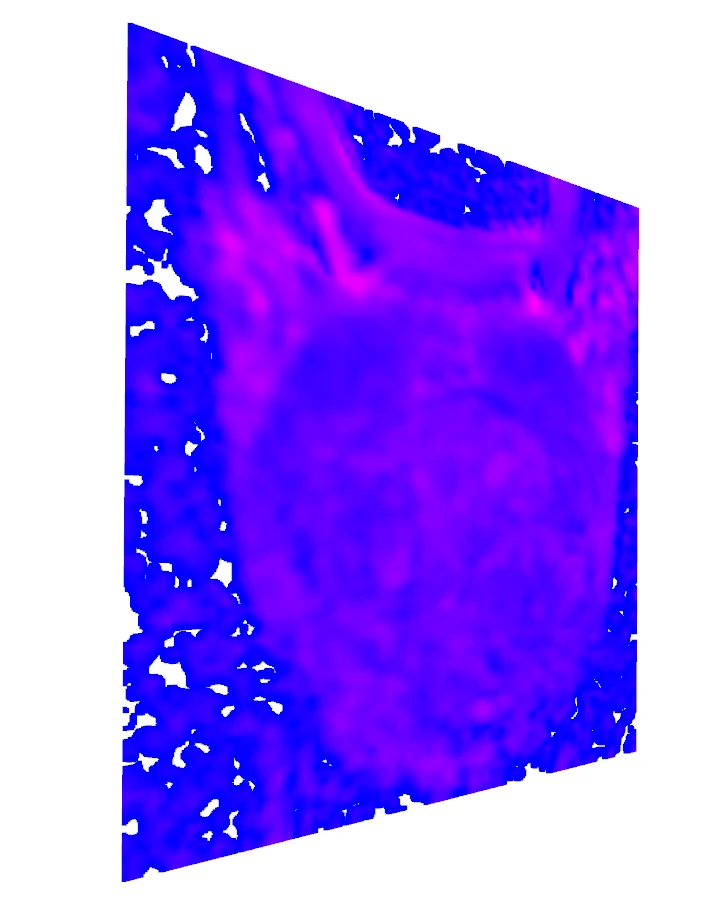 An exploratory colour-mapped MR slice rendered in the imaging reference frame